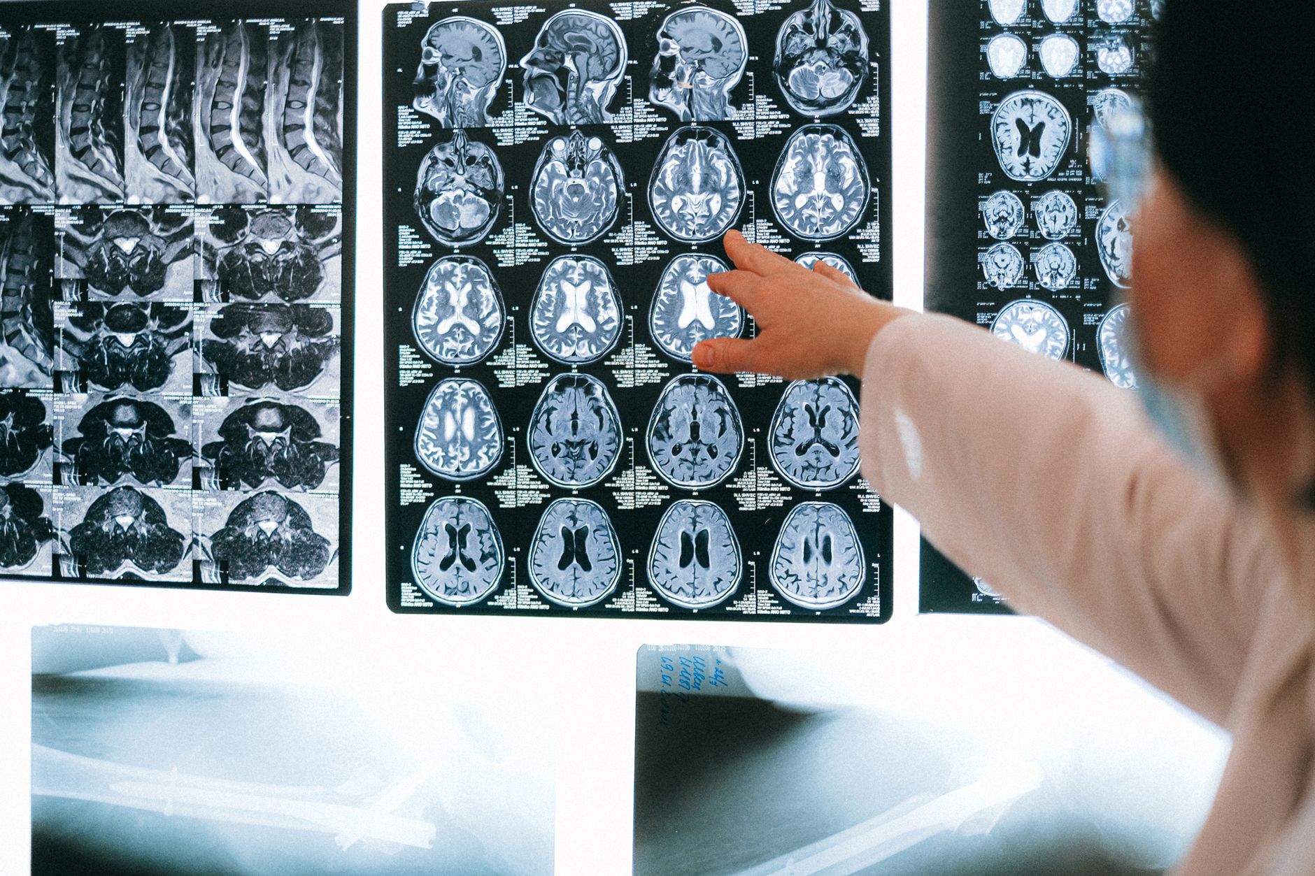 Neurophysiological Investigation of the Approach-avoidance Axis in OCD: Applications to Neuromodulation