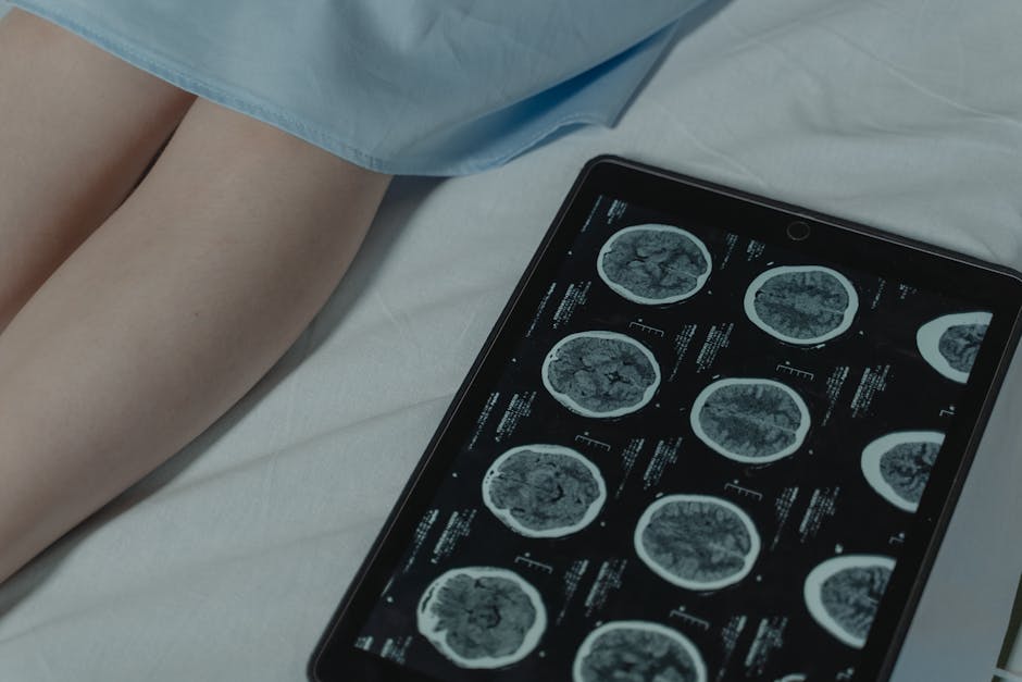 O uso de IA no diagnóstico de epilepsia