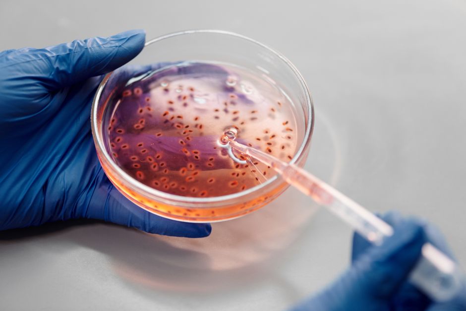 Genetic Analysis of Uncommon Disease Presentations in Non-US Populations