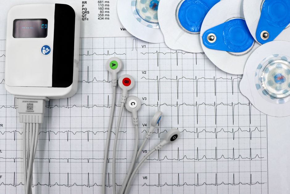 Identifying Electrocardiographic Markers to Determine Eligibility for the Implantation of a Subcutaneous Defibrillator.