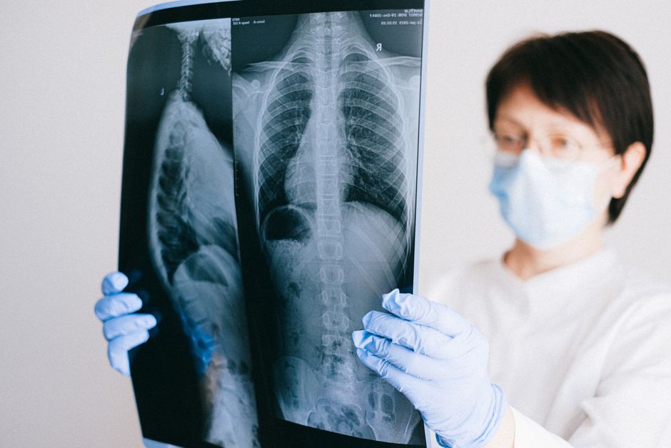 An Evaluation of Dose-escalation for Intrathoracic Tumours