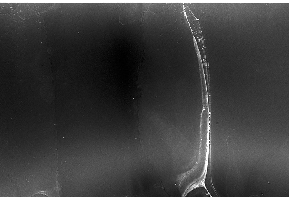 ERCPMP-Gx: Endoscopic Image and Video Dataset for Morphological, Histopathological, and Genomic Characterization of Colorectal Polyposis