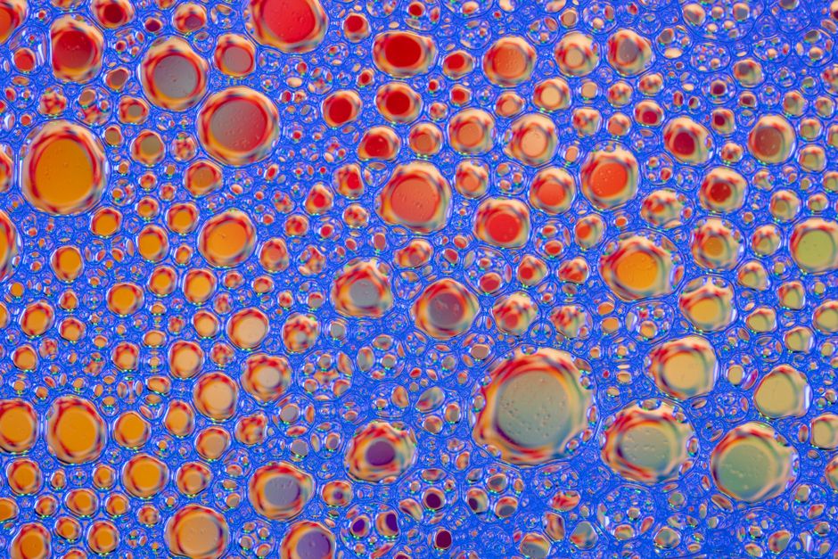 Molecular and Cellular Characterization of Skull Base Tumors